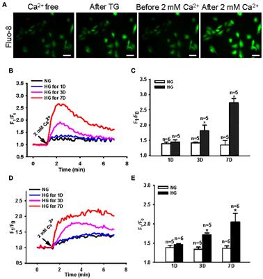 Enhanced Store-Operated Ca2+ Signal of Small Intestinal Smooth Muscle Cells Accelerates Small Bowel Transit Speed in Type 1 Diabetic Mouse